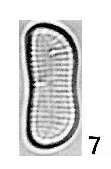 Colliculoamphora palawanensis